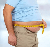 Obesity and Overweight